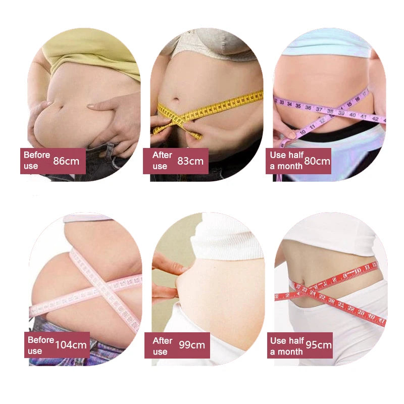 Shapewear Women Full Body Shaper Slimming Bodysuit Open Crotch Corset Waist Trainer Shaping Underwear Postpartum Recovery Sheath